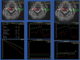 diapositiva49